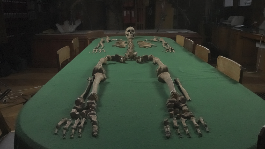 Skelett från en man som undersökts i studien. Foto: Vivement Lundi/France Télévisions
